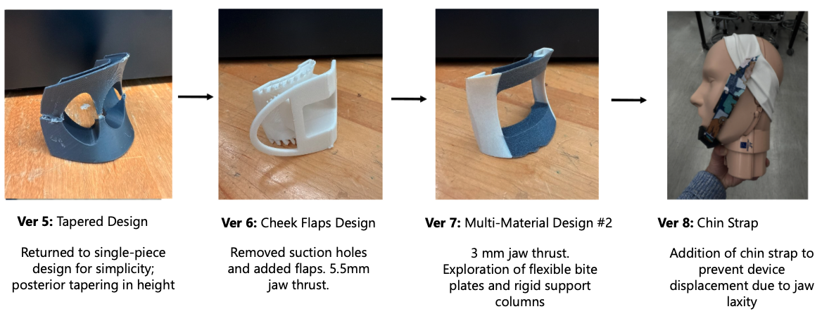 ApniBloc mouthguard prototypes versions 5 through 8 showing the progression from tapered design to chin strap integration
